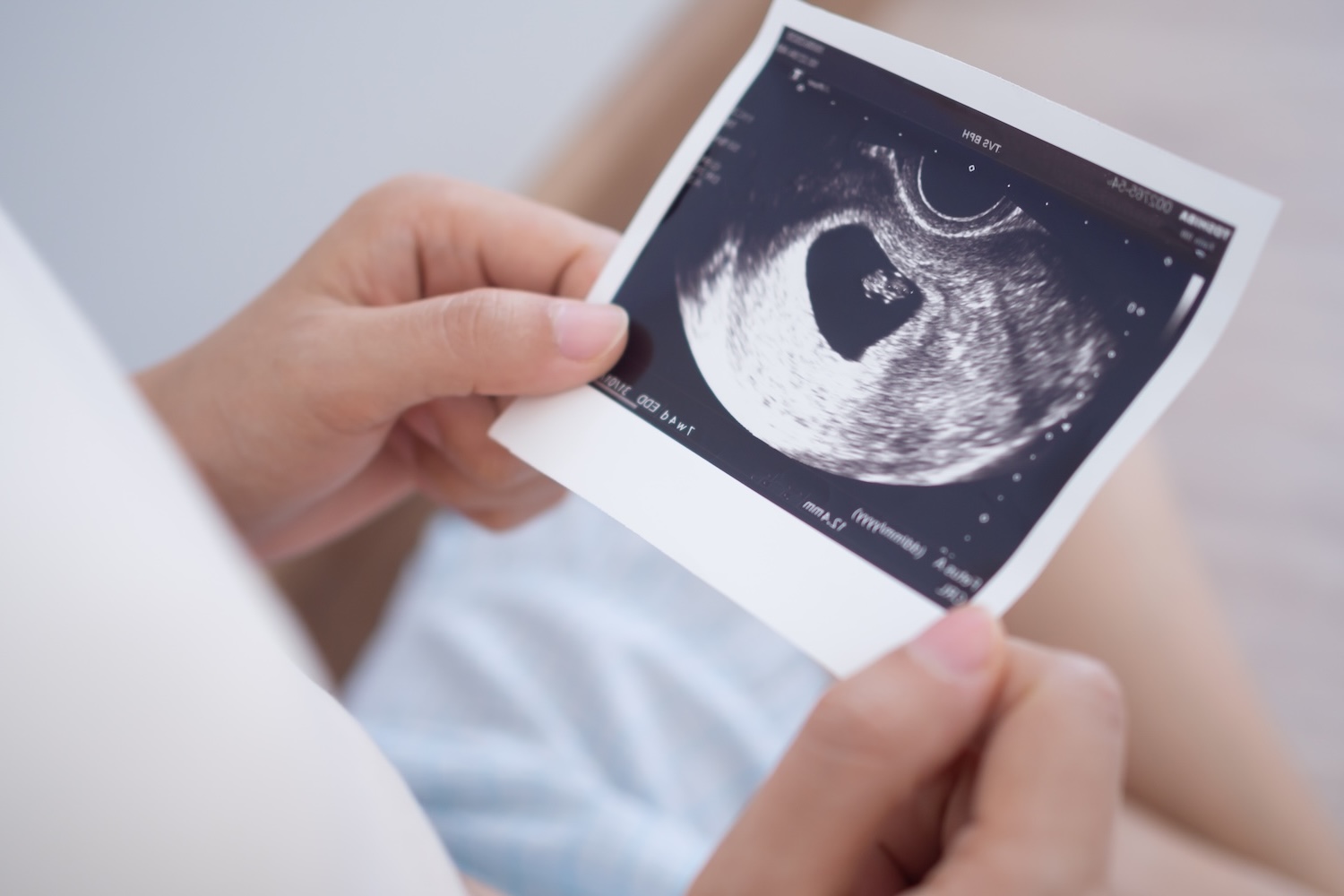 kelly-sikkema-IE8KfewAp-w-unsplash Pregnant woman looking at ultrasound