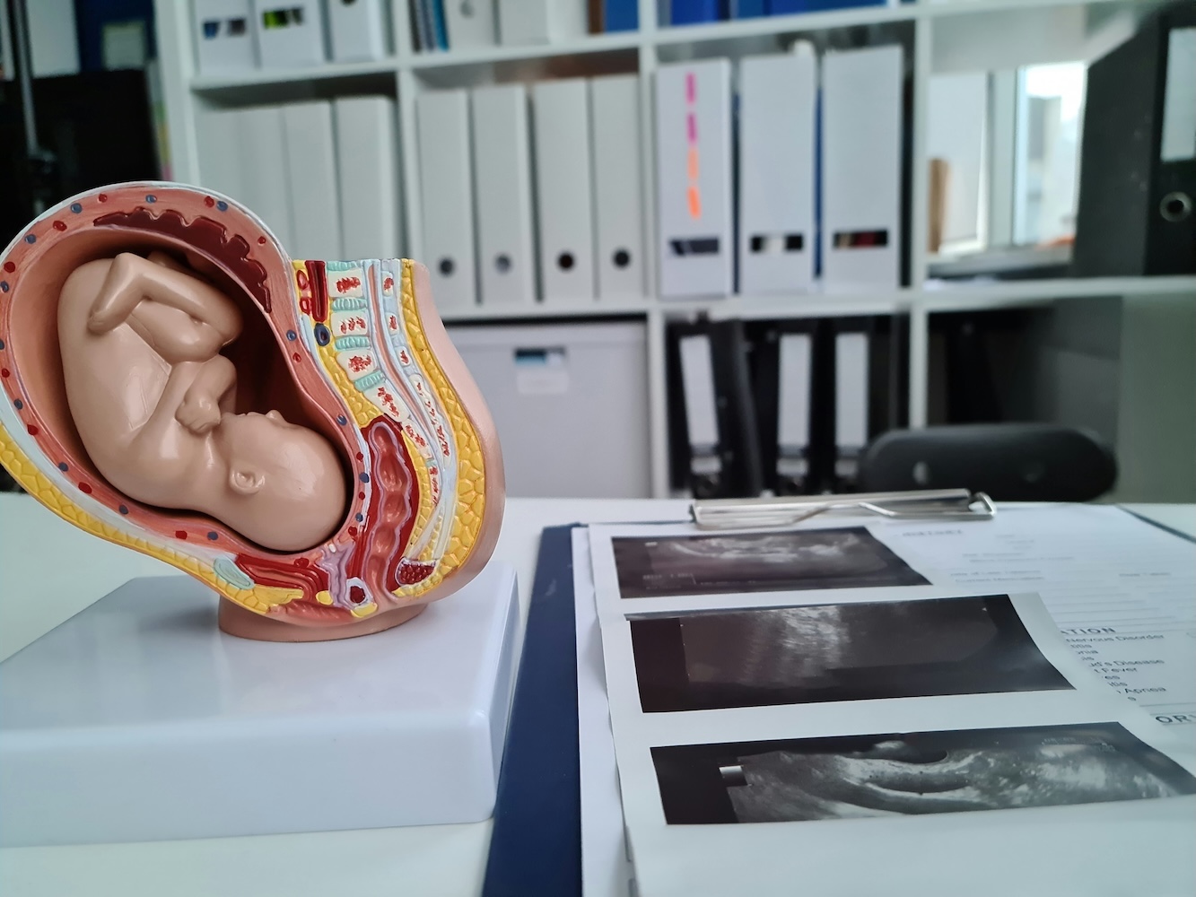 getty-images-nxbpmchoafk-unsplash A medical model of a fetus in the womb is on a table alongside ultrasound images and documents. Shelves with binders are in the background.